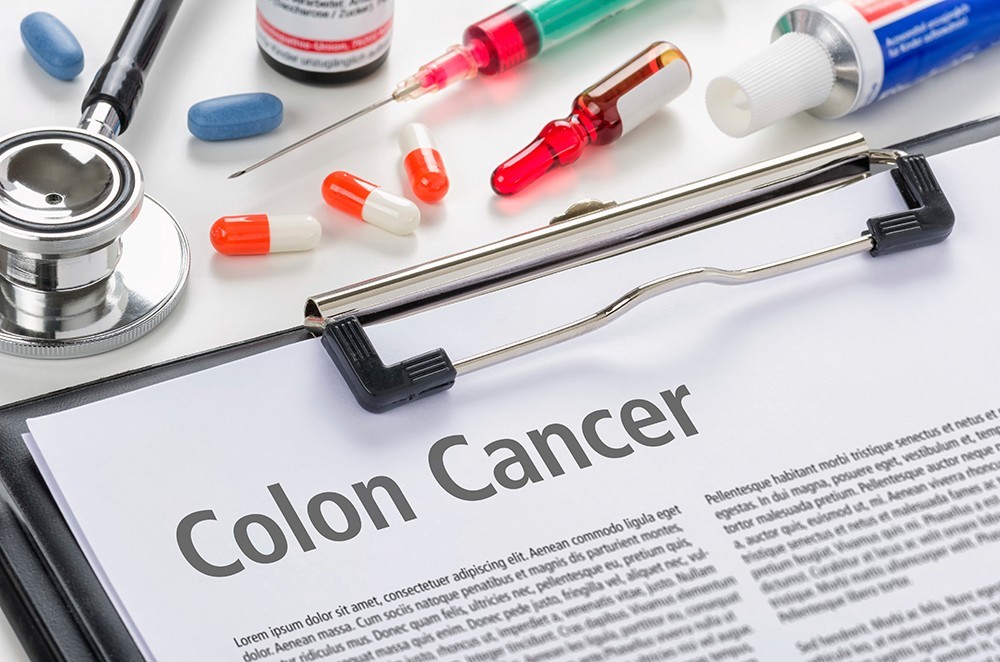 Diagnosis Colon Cancer